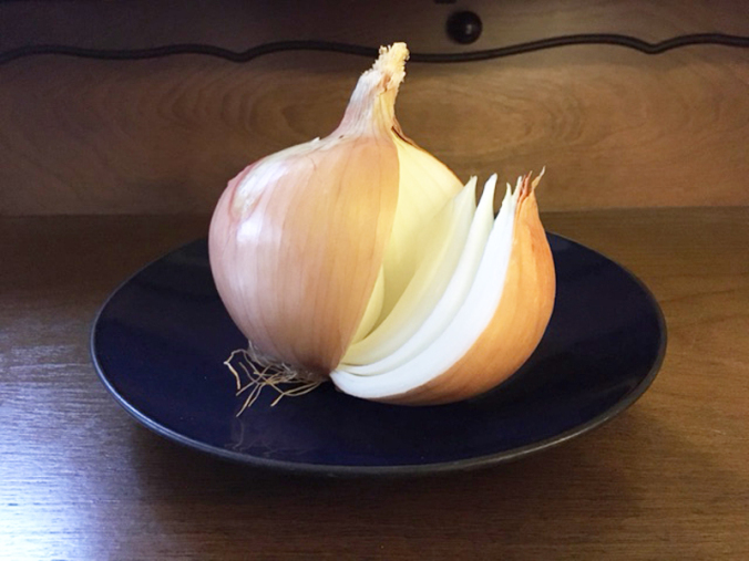 peeling-the-onion-parenting-adhd-autism